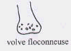 L'identification des champignons. Champignons à volve floconneuse.