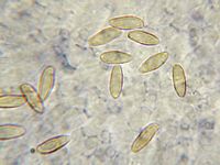 Bolet à beau pied. Spores. Cliquer pour agrandir l'image.