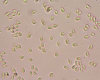 Chanterelle ciboire. Spores. Cliquer pour agrandir l'image.