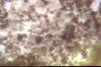Spores. Cliquer pour agrandir l'image.