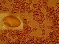 Spores. Cliquer pour agrandir l'image.