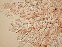 Spores. Cliquer pour agrandir l'image.