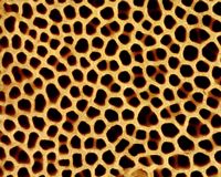 Nonnette voilée. Pores aggrandis. Cliquer pour agrandir l'image.