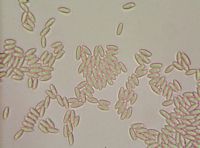 Nonnette voilée. Spores. Cliquer pour agrandir l'image.