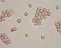 Pied de mouton ou hydne sinué. Spores. Cliquer pour agrandir l'image.