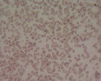 Satyre du chien. Spores. Cliquer pour agrandir l'image.