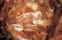 Mycorhize de la truffe des cerfs et de l'épicéa. Cliquer pour agrandir l'image.
