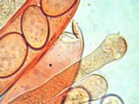 Spores asques et paraphyses. Cliquer pour agrandir l'image.