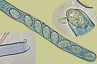 Asques et spores. Cliquer pour agrandir l'image.