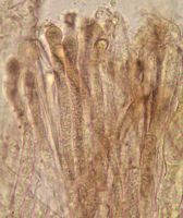 Paraphyses. Cliquer pour agrandir l'image.