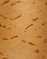 Pied surface. Cliquer pour agrandir l'image.