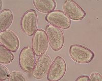 Ail des ours. Pollen. Cliquer pour agrandir l'image.