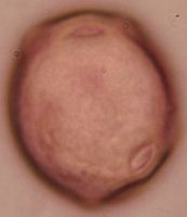 Aulne glutineux. Pollen. Cliquer pour agrandir l'image.