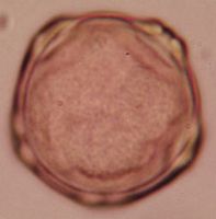 Aulne glutineux. Pollen de face. Cliquer pour agrandir l'image.
