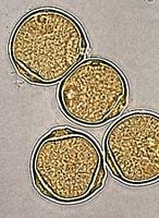 Bouleau verruqueux. Pollen. Cliquer pour agrandir l'image.