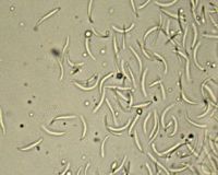 Le charme commun (Carpinus betulus). Dessous de feuille de charme attaquée par Acervuli. Cliquer pour agrandir l'image.