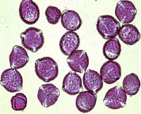 Chênes. Pollens. Cliquer pour agrandir l'image.