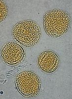 Frêne commun. Pollen. Cliquer pour agrandir l'image.