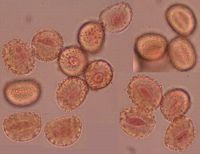Perce-neige, Pollen. Cliquer pour agrandir l'image.