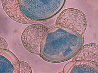 Pin maritime. Pollens. Cliquer pour agrandir l'image.