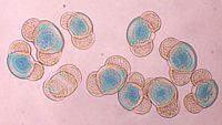 Pin maritime. Pollens. Cliquer pour agrandir l'image.