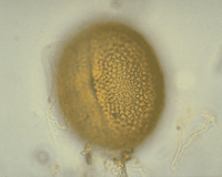 Renouée sarrasin. Pollen. Cliquer pour agrandir l'image.