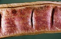 Robinier faux-acacia, Gousse. Cliquer pour agrandir l'image.
