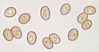 Agaric des jachères. Spores. Cliquer pour agrandir l'image.